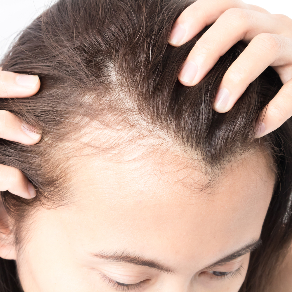Why Exactly Does My Hair Hurt? Experts Share How to Help Scalp Pain