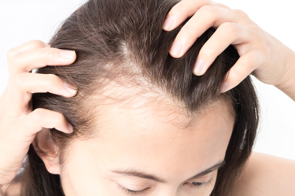 Hair Disorders: Finding the Root of the Problem