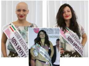 La miss con l'alopecia conquista la fascia e il pubblico