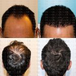 Benessere dei capelli - CRLAB